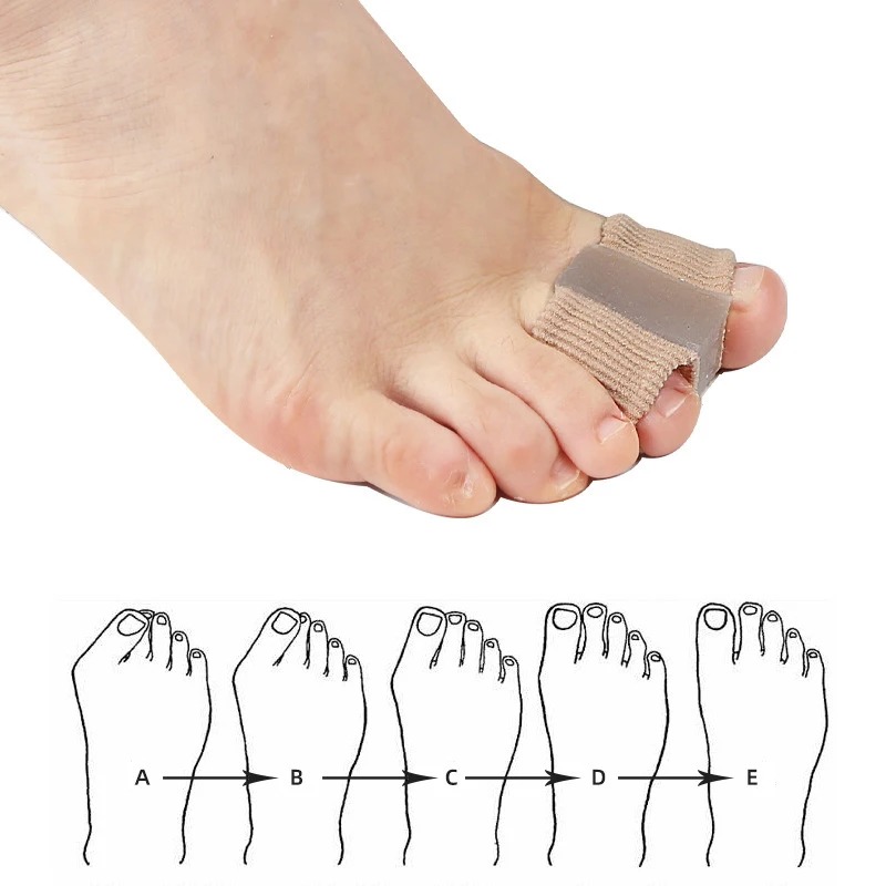 Set di 4 Separatori per Dita i - Yoga Toe Separator recensione e prezzo
