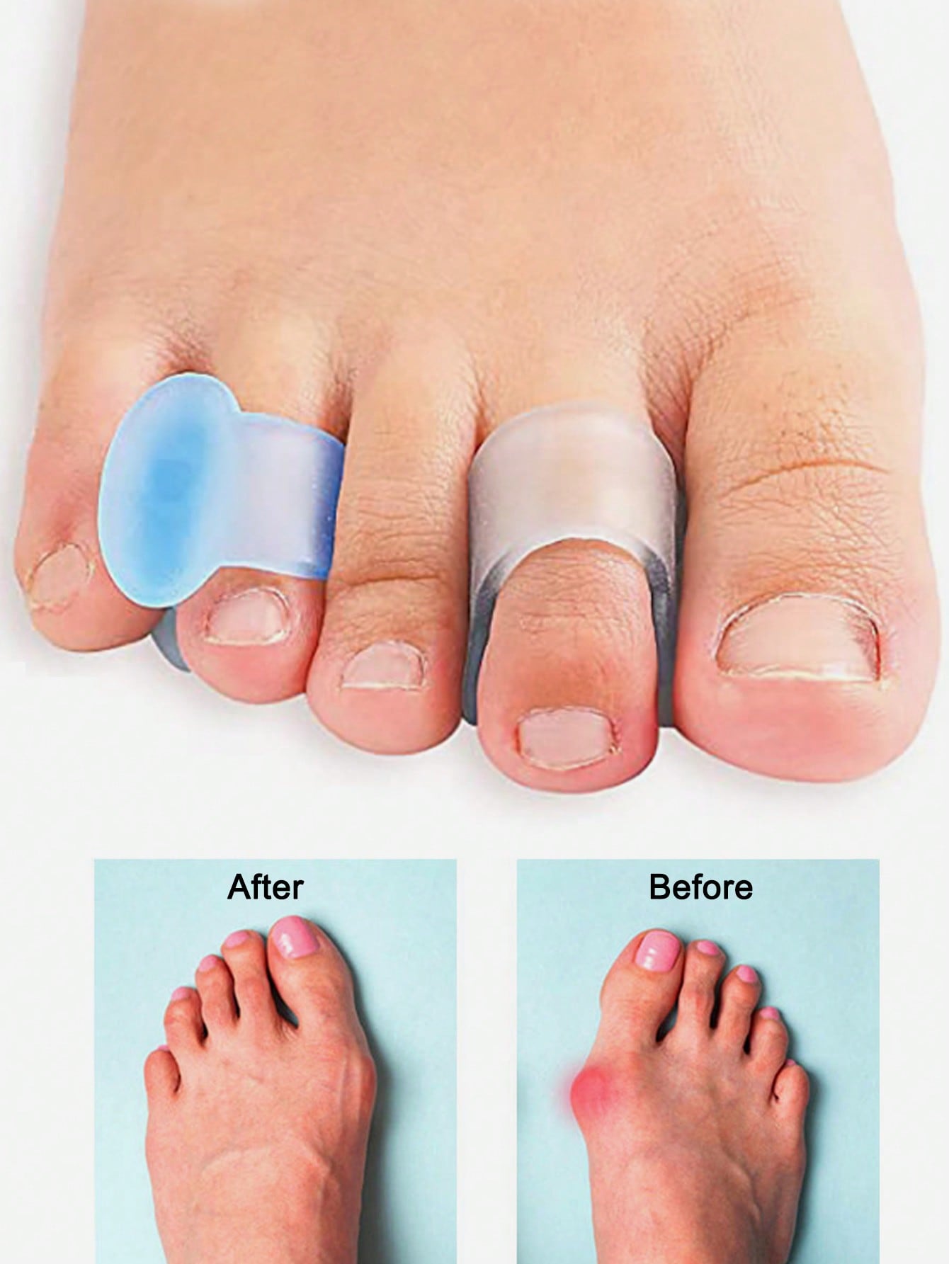 Separatore per Dita dei Piedi  - Yoga Toe Separator recensione e prezzo